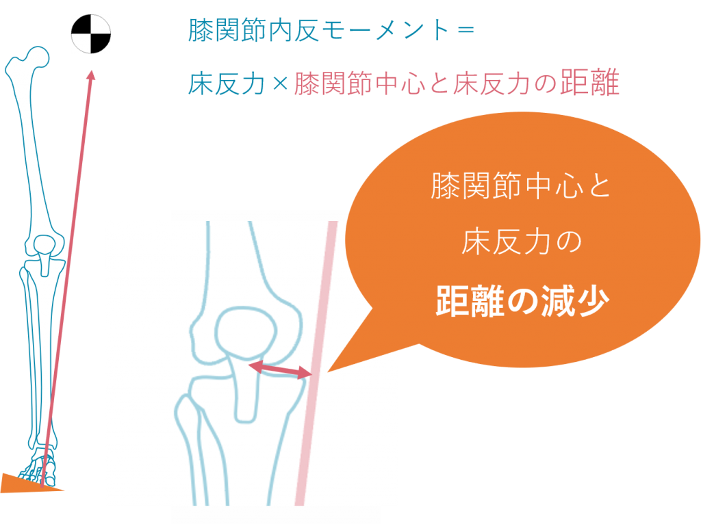 変形性膝関節症による膝の痛み O脚変形の軽減と予防が大切