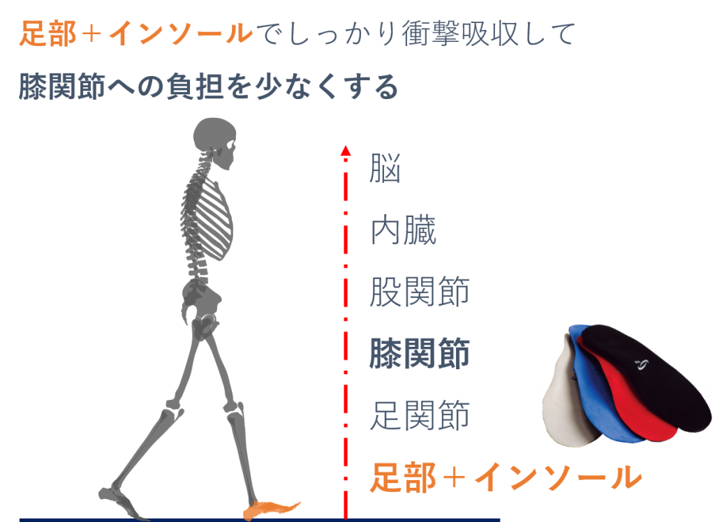 変形性膝関節症による膝の痛み O脚変形の軽減と予防が大切