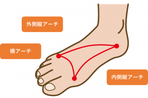 足のタコが痛い 削ってもすぐできる原因と対策