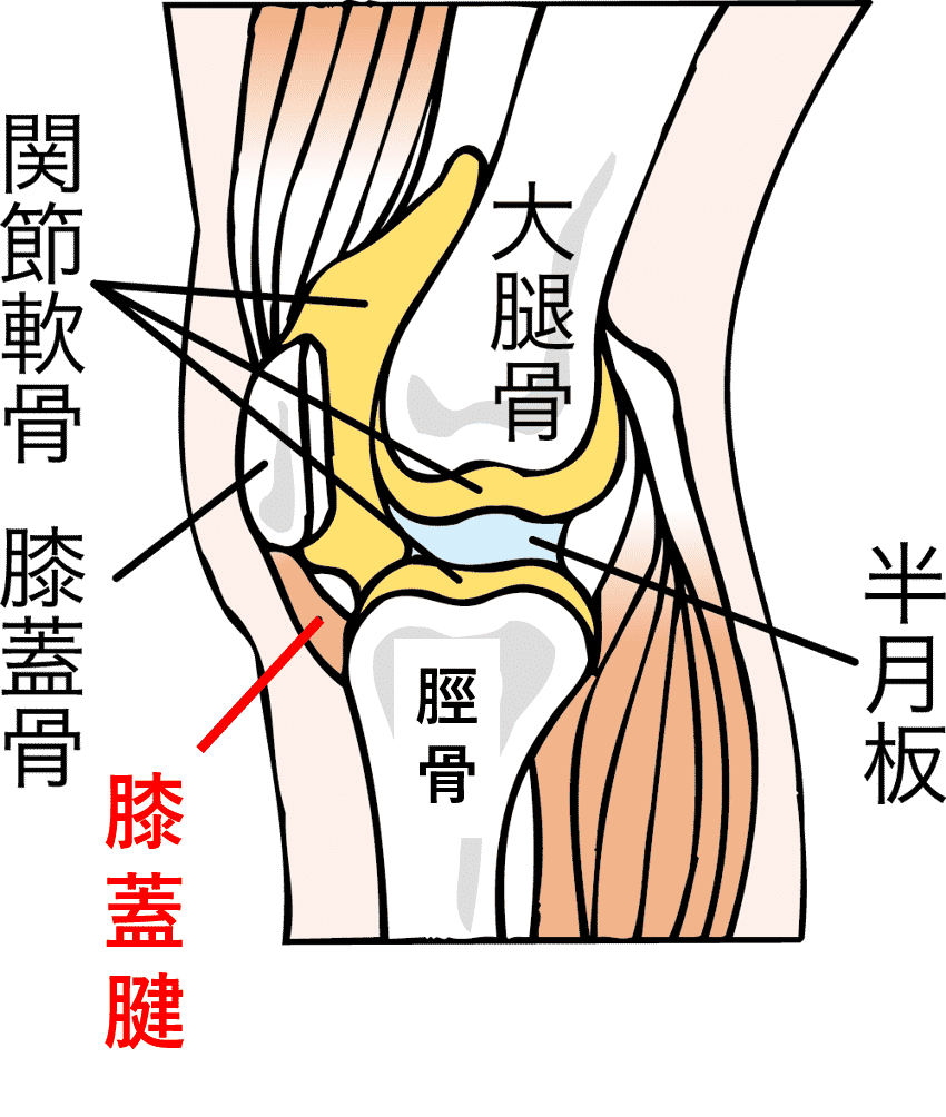 ジャンパー膝 膝蓋腱炎 の原因は慢性的な負担 その症状と対策とは