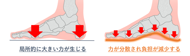 種子骨炎 種子骨障害の原因と対策とは インソール