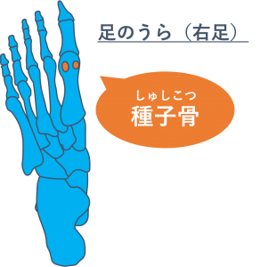 種子骨炎 種子骨障害の原因と対策とは インソール