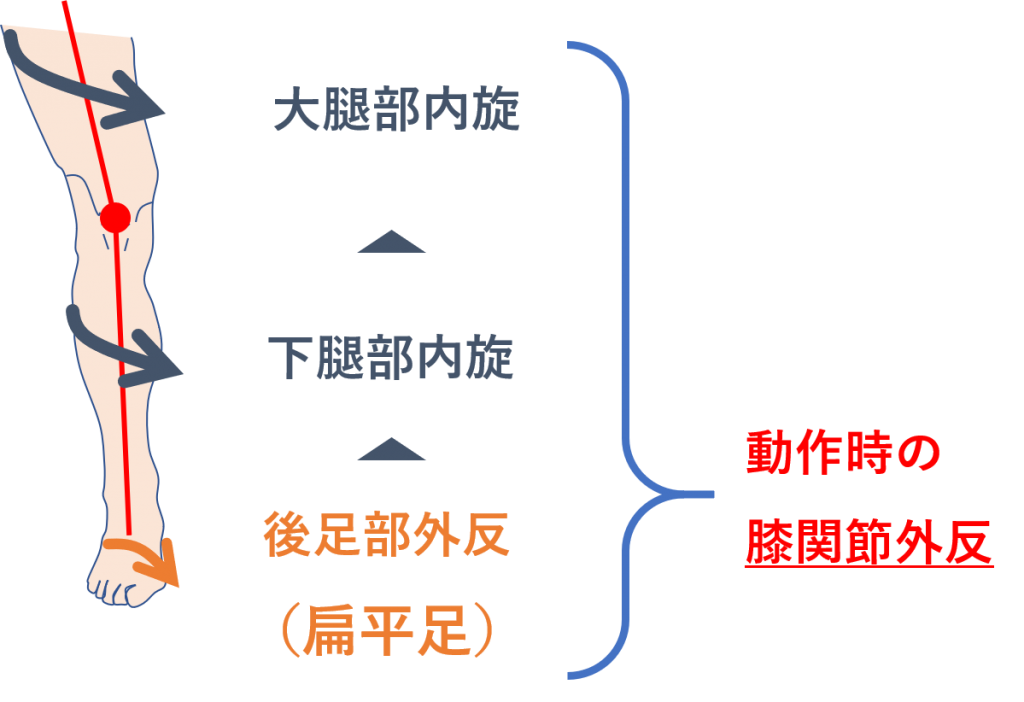 膝の前面の痛み 膝蓋大腿関節症候群と扁平足の関係とは